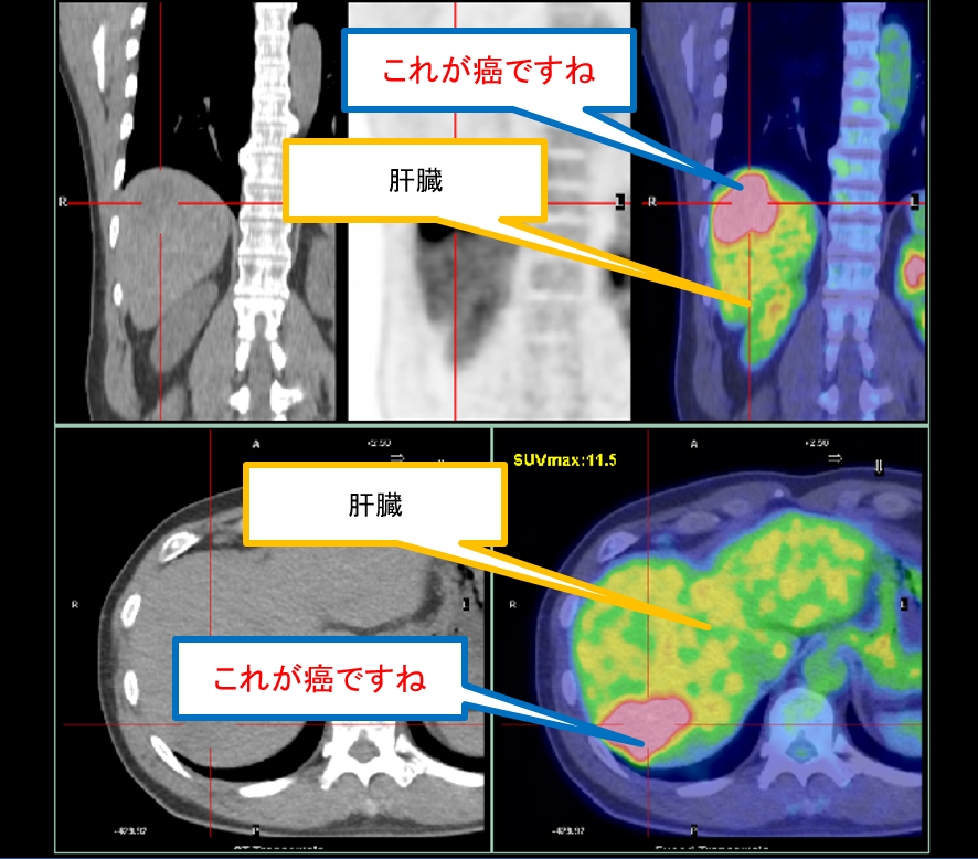 図1 (2).png